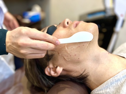 レイロールで脱毛専用ジェルを塗っている様子