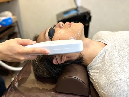 レイロールで脱毛器を使ってヒゲ脱毛をしている様子