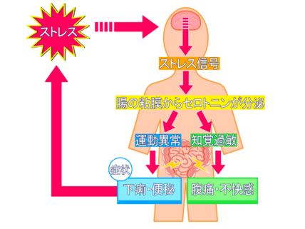 過敏性腸症候群のイラスト